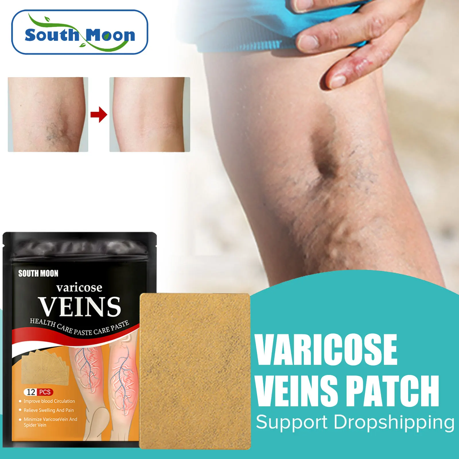 South Moon เส้นเลือดขอด Patch Treatment Vasculitis Phlebitis Spider บวมไส้เดือนเก่า Rotten ขาปวดบรรเทาพลาสเตอร์