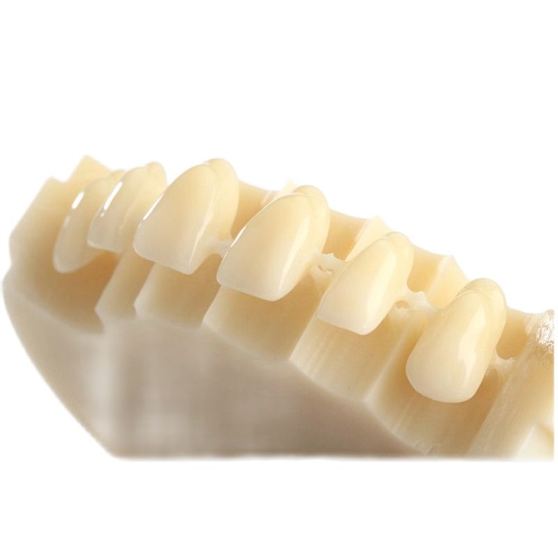 Green PMMA 5 buah ZZ9518mm monokrom Zirkonzahn CAD CAM Resin Disc -Dental Lab bahan gigi putih