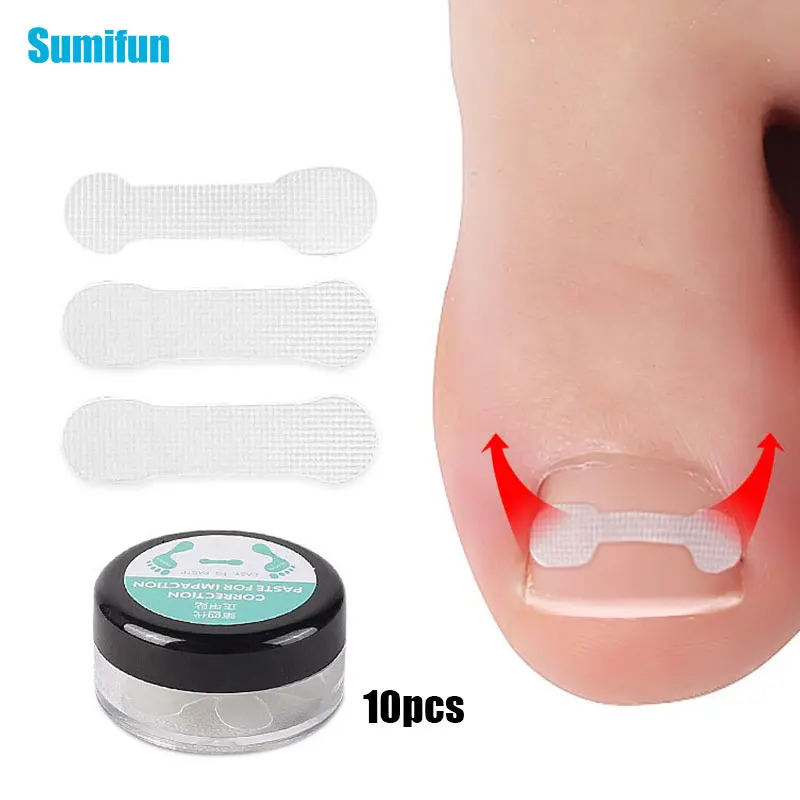 10 шт./кор., инструмент для коррекции вросших ногтей, зажим для выпрямления, скобка для лечения вросших ногтей, эластичный патч, наклейка, инструмент для педикюра
