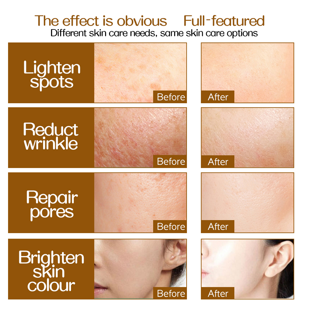 Zgts 192 titânio derma rolo micro agulhas sistema dermaroller mesotherapy para facial 0.2/0.25/0.3mm agulhas comprimento mesoroller