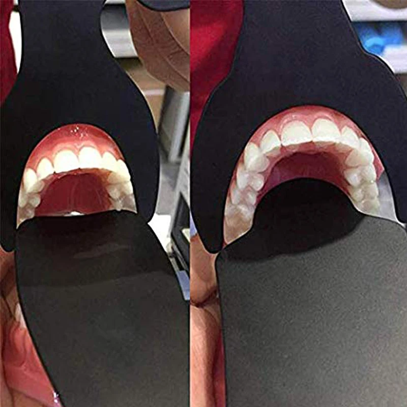 6 Cái/bộ Nha Sĩ Nha Khoa Ảnh Tương Phản Đen Bavico Autoclavable Nha Khoa Tương Phản Intraoral Chụp Ảnh Gương