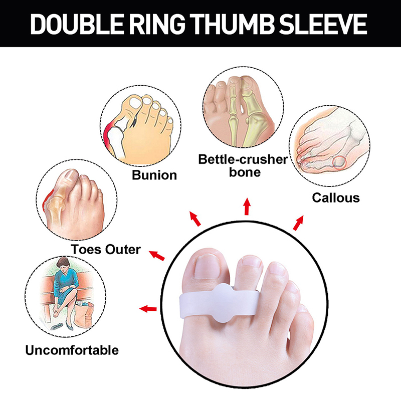 Separador de dedos del pie de Gel de silicona, Protector de dedos del pie, Corrector de dedo gordo del pie, herramienta de cuidado de pies de pedicura, 2 piezas