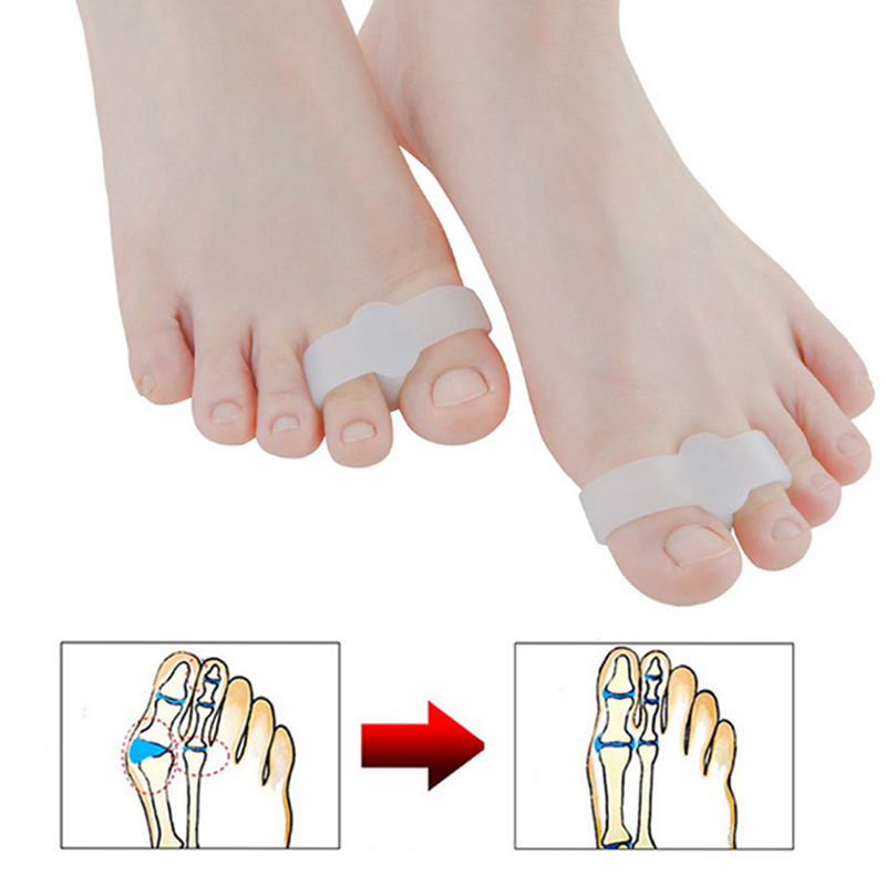 Separador de dedos del pie de Gel de silicona, Protector de dedos del pie, Corrector de dedo gordo del pie, herramienta de cuidado de pies de pedicura, 2 piezas