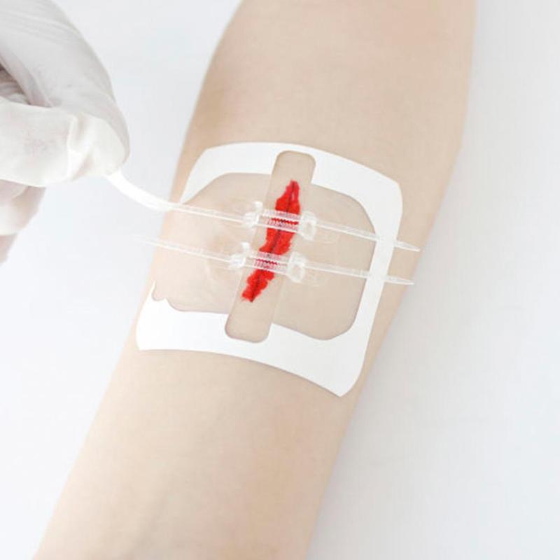 Zipper Tie Wound Encerramento Hemostatic Patch, Sutura Rápida, Band-Aid, Portátil, Ao Ar Livre, 1 Pc, 3 Pcs, 5Pcs