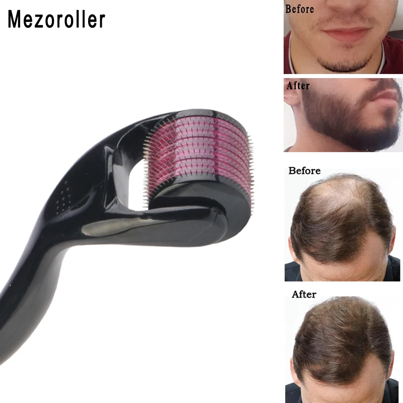 Mezoroller-マイクロニードルスキンマッサージャー,髪を再生するための針付きマイクロニードル,スキンケア,ボディトリートメント,540コレクション  0.2 / 0.25 / 0.3 / 0.5 / 0.75 / 1.0 / 1.5 / 2.0 / 2.5 / 3.0