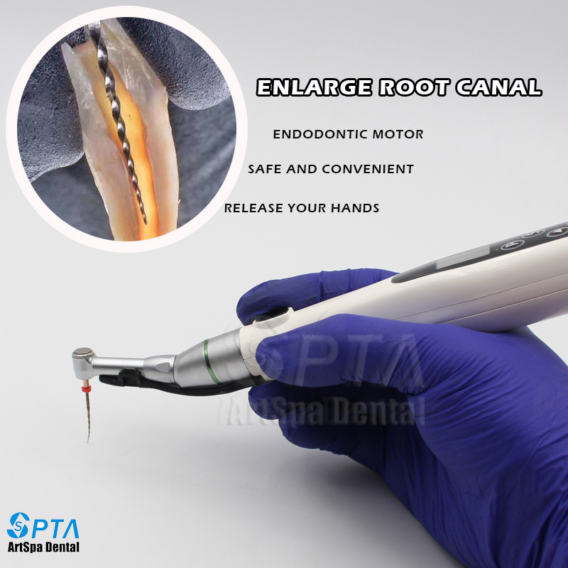 SPTA 16:1 contraángulo turbina de baja velocidad pieza de mano con archivo de conducto radicular alternativo tratamiento endodóntico materiales de odontología