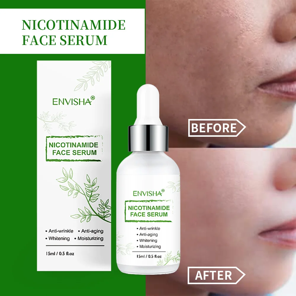 Suero de nicotinamida para el cuidado de la piel, colágeno, ácido hialurónico, Retinol, blanqueamiento antienvejecimiento, reduce los poros, controla la hidratación profunda