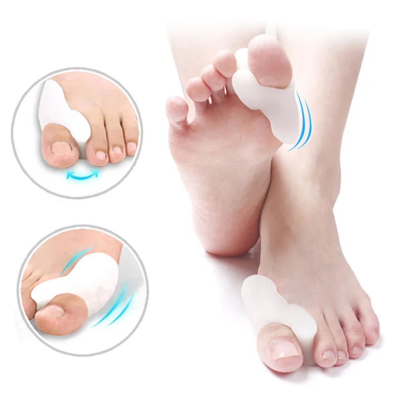 1 คู่ซิลิโคนนิ้วเท้าแยก Bunion Bone Ectropion Adjuster นิ้วเท้าด้านนอกอุปกรณ์เท้าเครื่องมือดูแล Hallux Valgus Corrector