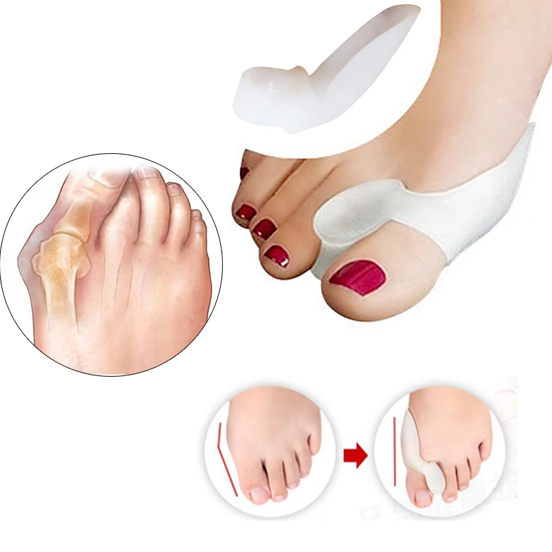 1 คู่ซิลิโคนนิ้วเท้าแยก Bunion Bone Ectropion Adjuster นิ้วเท้าด้านนอกอุปกรณ์เท้าเครื่องมือดูแล Hallux Valgus Corrector