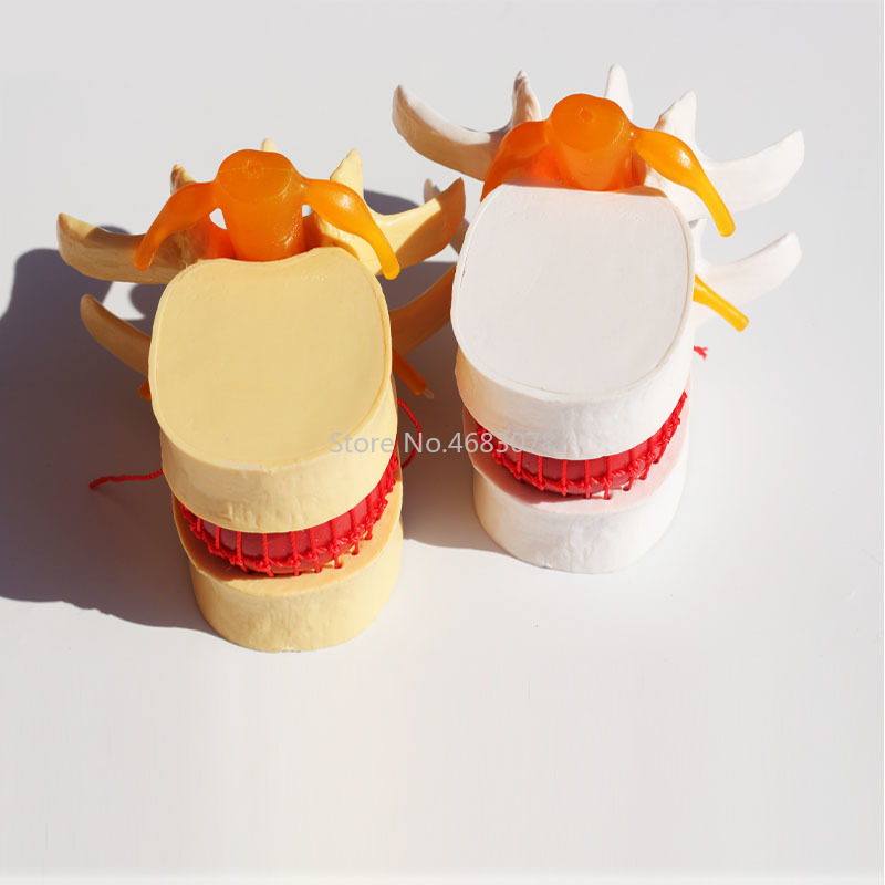 Menschliche Anatomie Skelett Wirbelsäule Bandscheibenvorfall Lehrmodell Gehirn Schädel Traumatische Pistole Schulbedarf Medizinisches Instrument