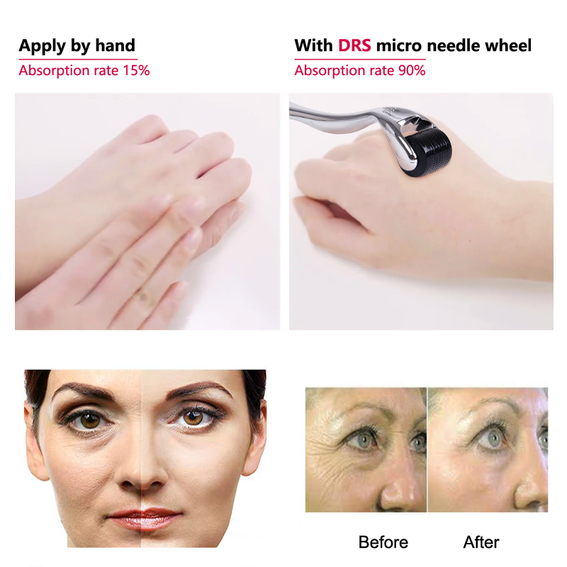 Darsonval-rolo titanium puro do derma para a cara, comprimento das agulhas de 0.2/0.25/0.3mm, para a cara, 540