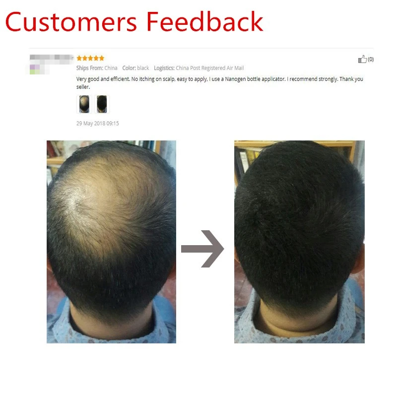 Tóc Xây Dựng Sợi Keratin Dày Hơn Chống Rụng Tóc Sản Phẩm Che Khuyết Điểm Nạp Làm Dày Tóc Sợi Bột Tăng Trưởng Sevich 25G