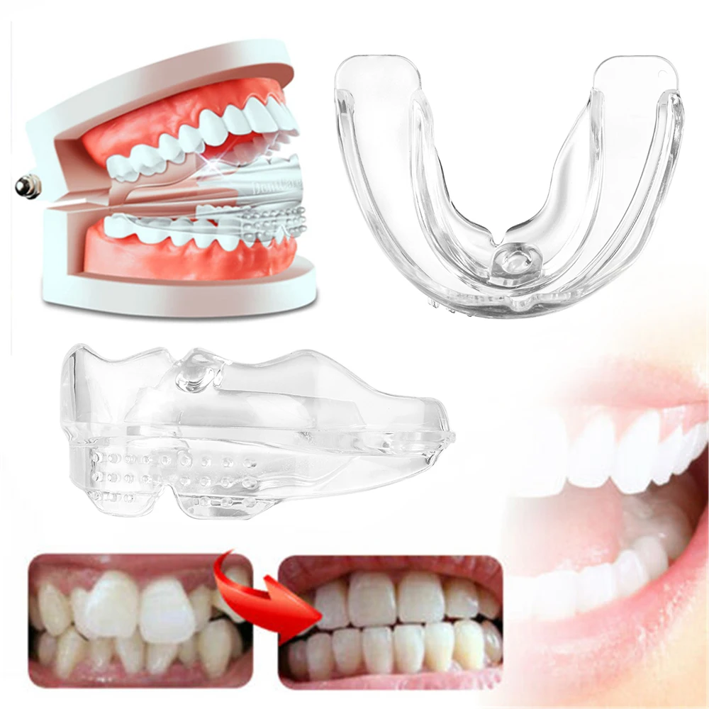4D Chỉnh Nha Nẹp Thiết Bị Nha Khoa Nẹp Ốp Căn Chỉnh Huấn Luyện Răng Giữ Bruxism Bảo Vệ Miệng Răng Cực Bền