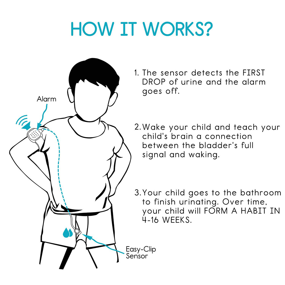 MoDo-king 子供用の最高のおねしょアラーム 赤ちゃんの夜尿モニター 失禁補助具 夜尿治療には AG 電池が含まれています