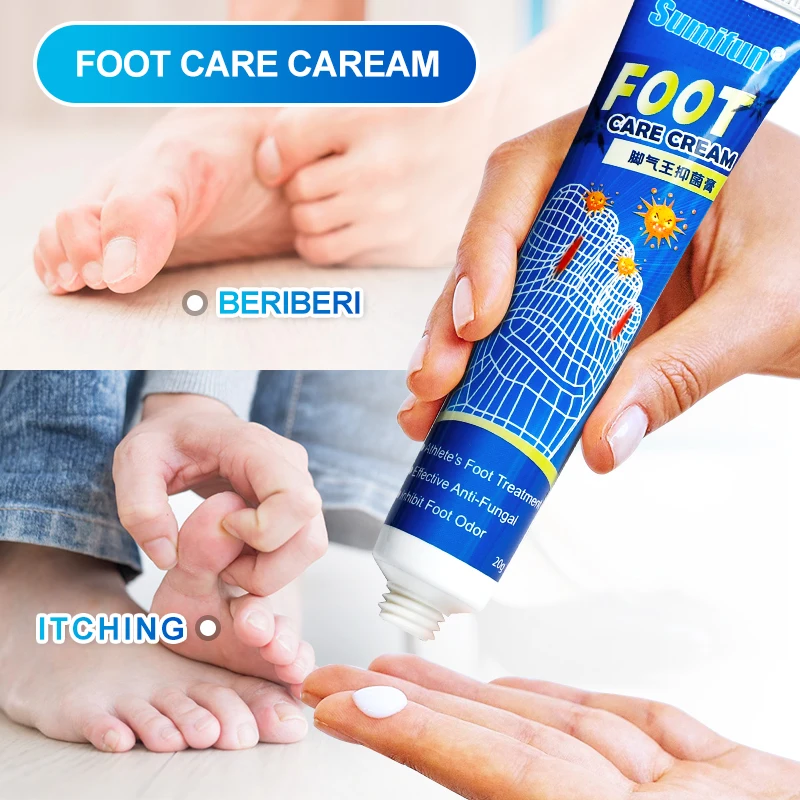 Sumifun-Crema de Beriberi para pies, ungüento antibacteriano de hierbas chinas, antihongos, yeso, picazón, olor, pelado, ampolla de maíz, nuevo