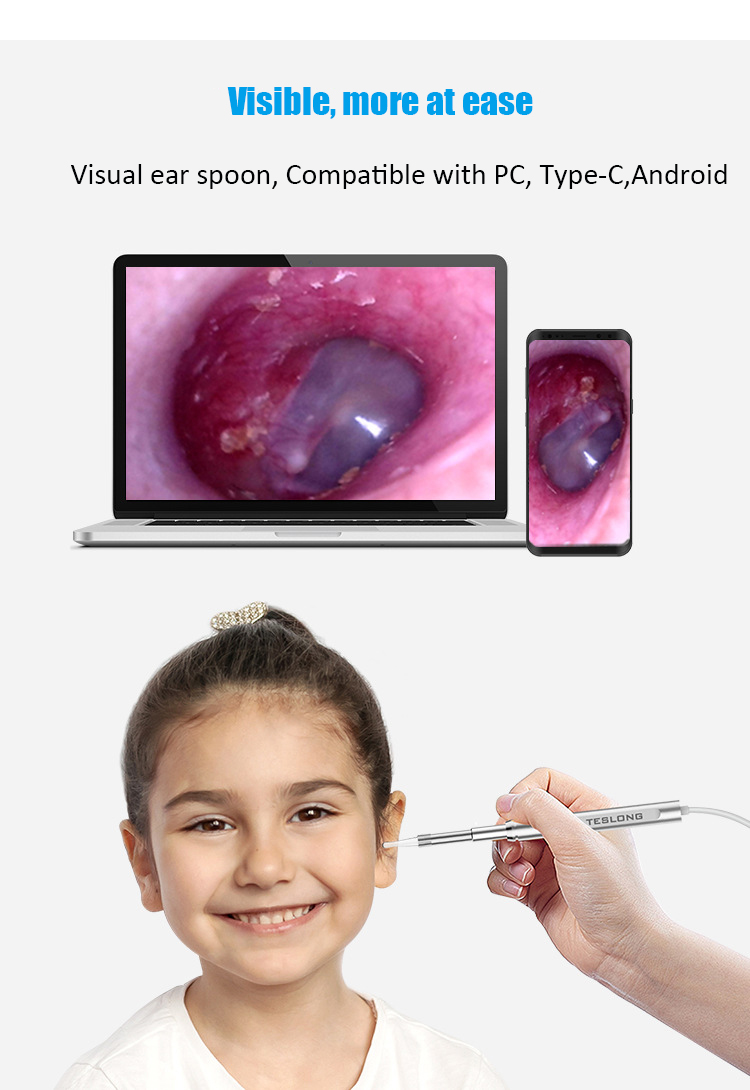 Otoskop WiFi 3.9Mm/5.0Mm Endoskopi Pembersih Telinga HD 1080P Kamera Telinga Nirkabel Giroskop 5 Sumbu Alat Penghilang Kotoran Telinga untuk Anak-anak