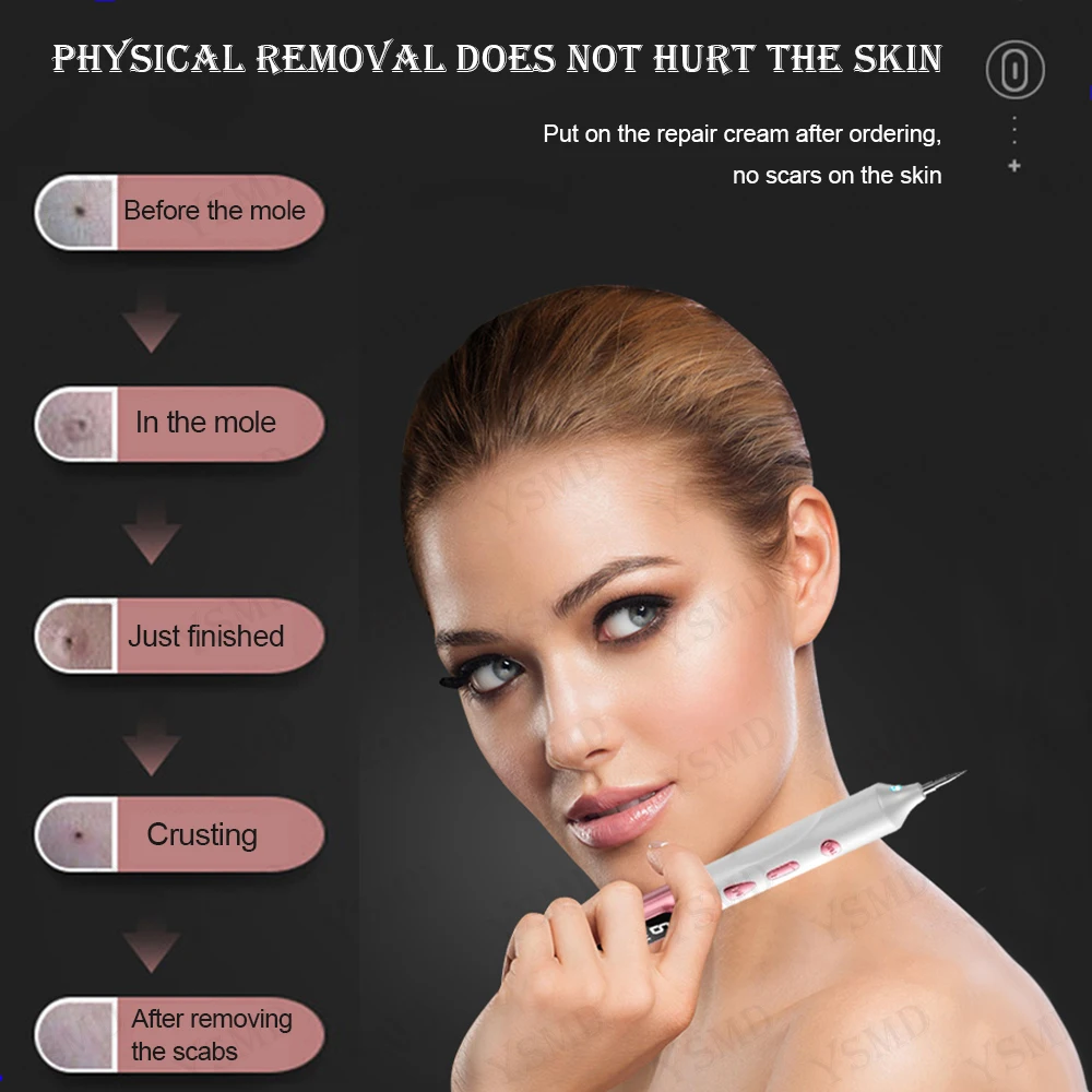 Clearance_Laser Plasma Pen for Skin Tag Remover Freckle Black Dot Papilloma Warts Mole Pimples Tattoo Removal Laser Pen Beauty C