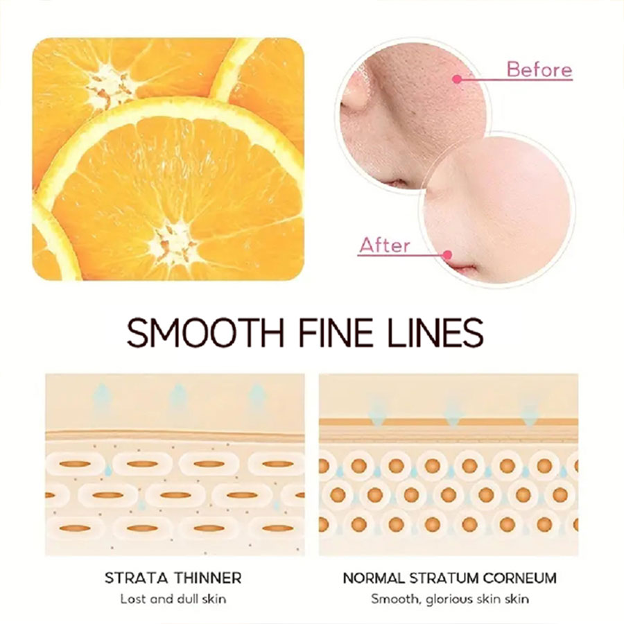 YOUNGCOME-VitaminC Creme Facial, SkinCare, Pigment Spots, Removedor de Sardas, Clareamento, Hidratante, Anit-Envelhecimento, Beleza, Saúde, Cosméticos