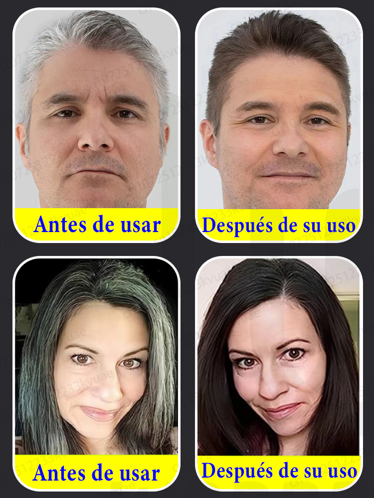 Esencia antiblanqueo natural pura, elimina las canas y vuelve el cabello negro desde la raíz.