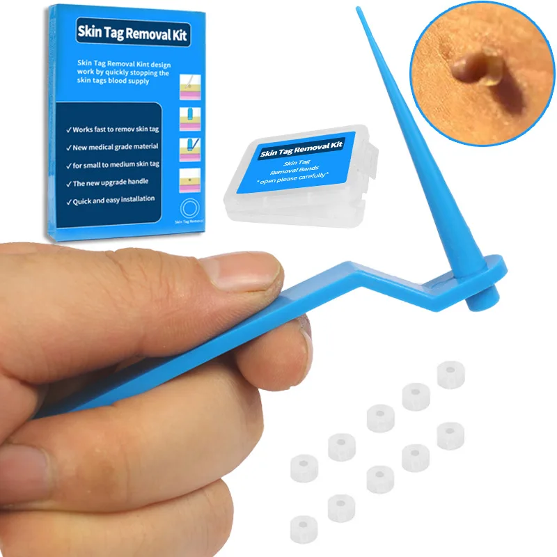 1 conjunto de kit de remoção de etiqueta de pele, removedor de verrugas, micro banda, kit de remoção de etiqueta de pele, conjunto de ferramentas de tratamento de etiqueta, ferramentas de beleza para 1-5mm