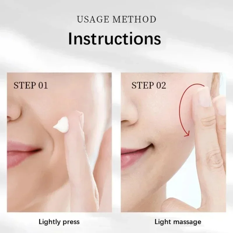Face Freckle Cream Effective Remove Dark Spot Melasma Fade Melanin Anti-pigmentation Improve Dullness Whiten Skin Care Products