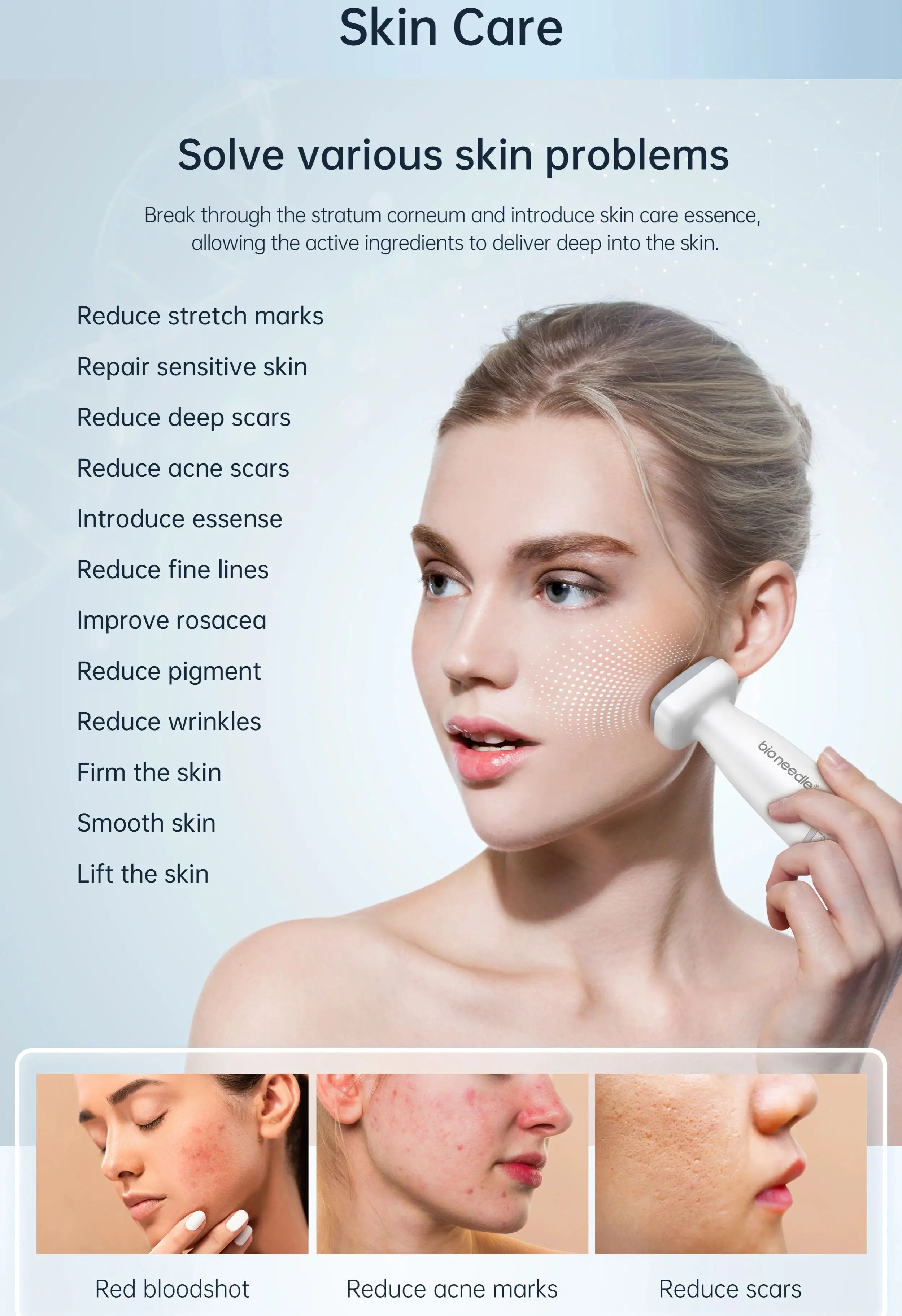 Hello Face Derma STAMP เข็ม120เข็มเข็มปรับได้การดูแลผิวด้วยเข็มขนาดเล็กระบบลูกกลิ้งการสูญเสียเส้นผมการบำบัดการเจริญเติบโตของเครา