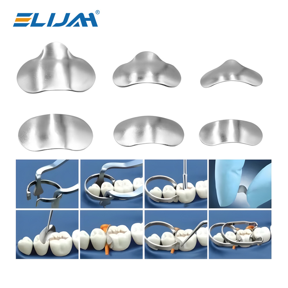 Denspay 100 stks/doos Tandheelkundige Sectionele Matrix Systeem Tandheelkundige Sectionele Matrix Band Hars Vastklemmen/Seperkende Ring Tandarts Gereedschap