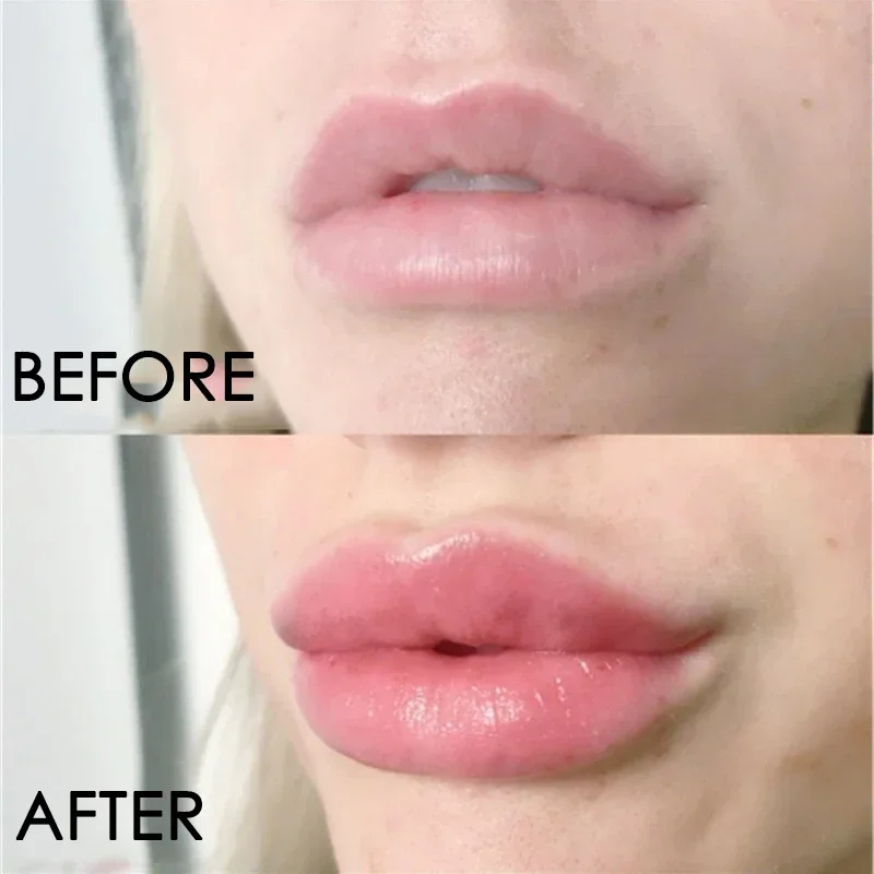 Suero regordete de labios Sexy, aumenta la elasticidad de los labios, aceite esencial voluminizador instantáneo, Reduce las líneas finas, reparación, nutre, belleza, cuidado de los labios