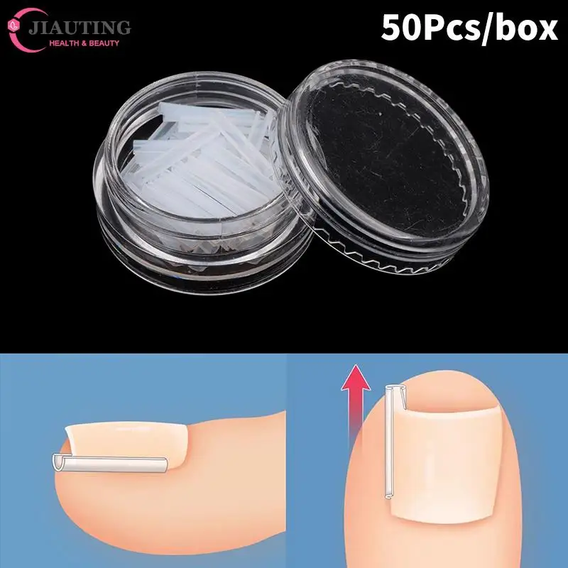 50Pcs Ingrown Toe Nail Treatment Elastic Patch Sticker Straightening Clip Brace Pedicure Tool  Ingrown Toenail Correction Tool