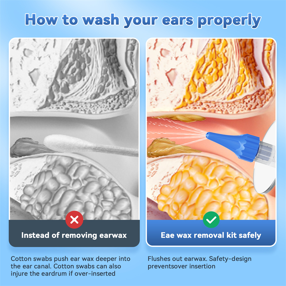 EAR WAX Removal คู่มือทําความสะอาดหูน้ํา Earwax Removal Kit หูชลประทาน Flushing System ชุดทําความสะอาดหูปลอดภัยและมีประสิทธิภาพ