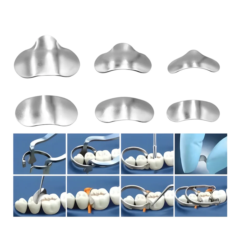 Denspay 100 ชิ้น/กล่องทันตกรรม Sectional Matrix ระบบทันตกรรม Sectional Matrix Band เรซิ่นหนีบ/แยกแหวนเครื่องมือทันตแพทย์