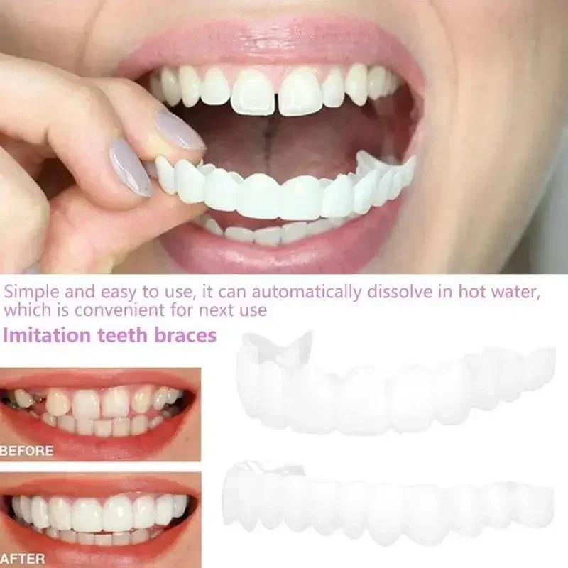 Juego de dentaduras postizas ajustables para adultos, dientes falsos ajustables a presión, tirantes portátiles, decorar huecos para mejorar la estética, 2024