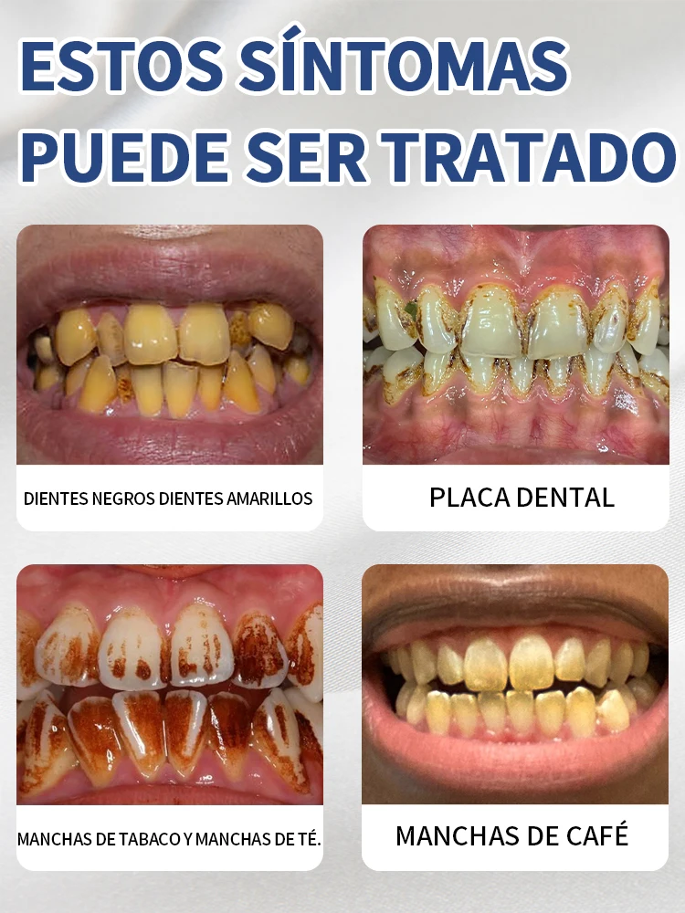 Resolver todos los problemas dentales