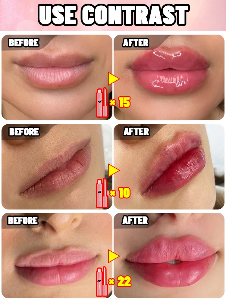 From thin lips to full lips, you can easily achieve it!