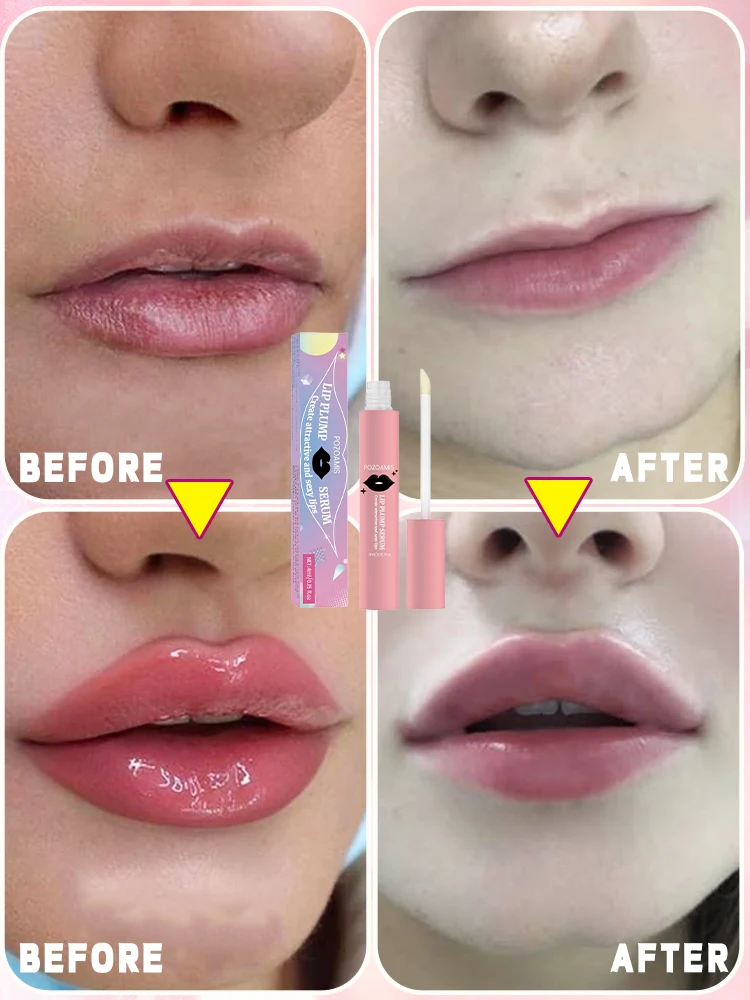 From thin lips to full lips, you can easily achieve it!
