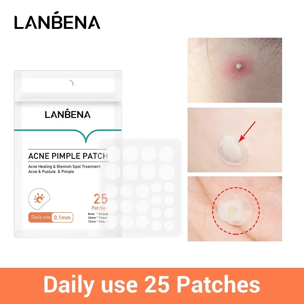 LANBENA Acne Pimple Patch 25pcs Daily Use Invisible Acne Stickers Blemish Treatment Acne Concealer Makeup