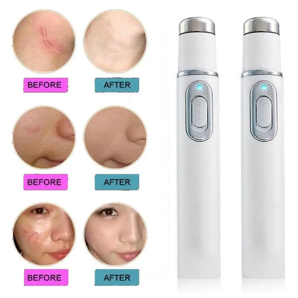 Herramienta de Spa para ojos portátil y práctico calma los ojos cansados corriente 0.6a revolucionario 130*15mm masajeador de ojos con luz azul avanzada