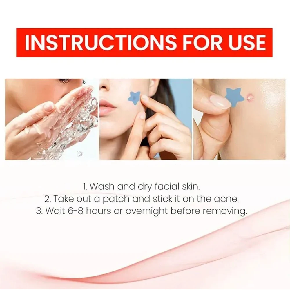 Star Acne Pimple Patches Colorful Breathable Acne Removal Absorb Secretions Anti Infection Originality Concealer Makeup Tool