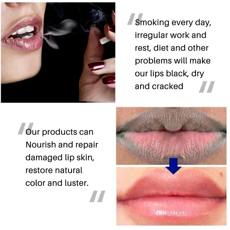 Quitar humo oscuro bálsamo labial aclarador melanina blanqueamiento brillo aceite labios lápiz labial rosa exfoliante desvanecimiento líneas de labios cosméticos Coreanos