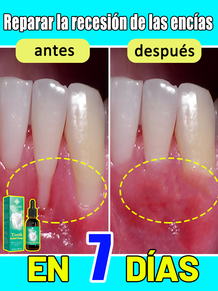 Repara las encías dañadas, alivia el dolor de las encías, fortalece las encías y restauran las encías saludables.