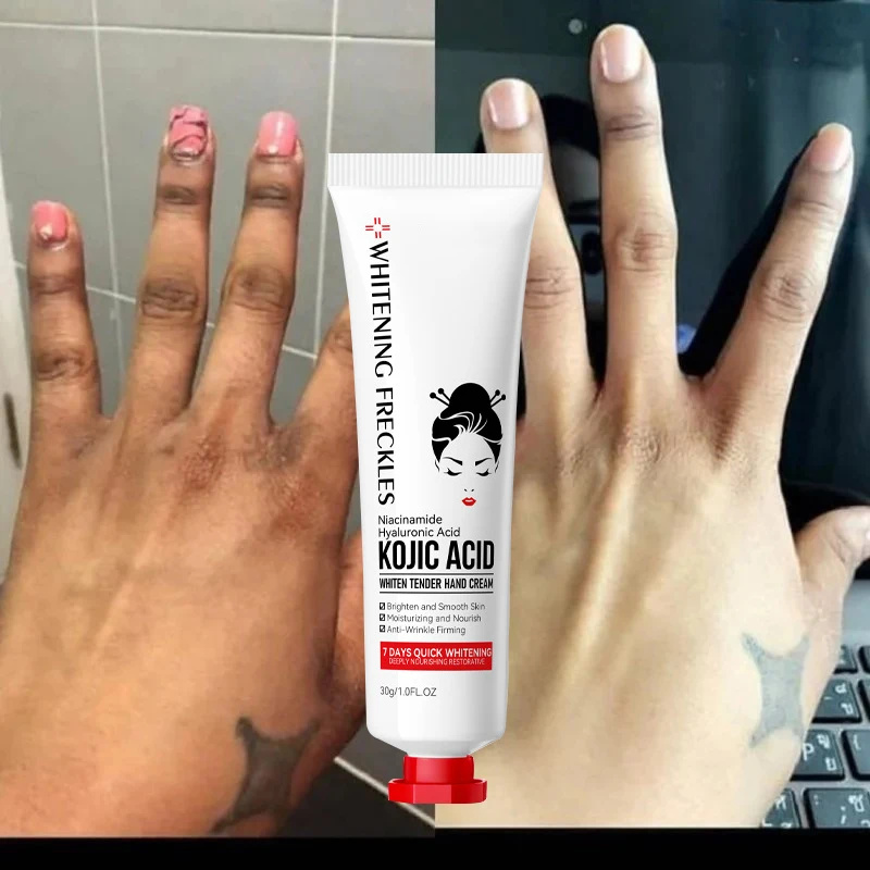 Fade Dullness Hand Cream Anti-wrinkle Remove Cracked Lotion Body Fast Lighten Black Skin Brighten Smooth Nourish Moisturizer 30g