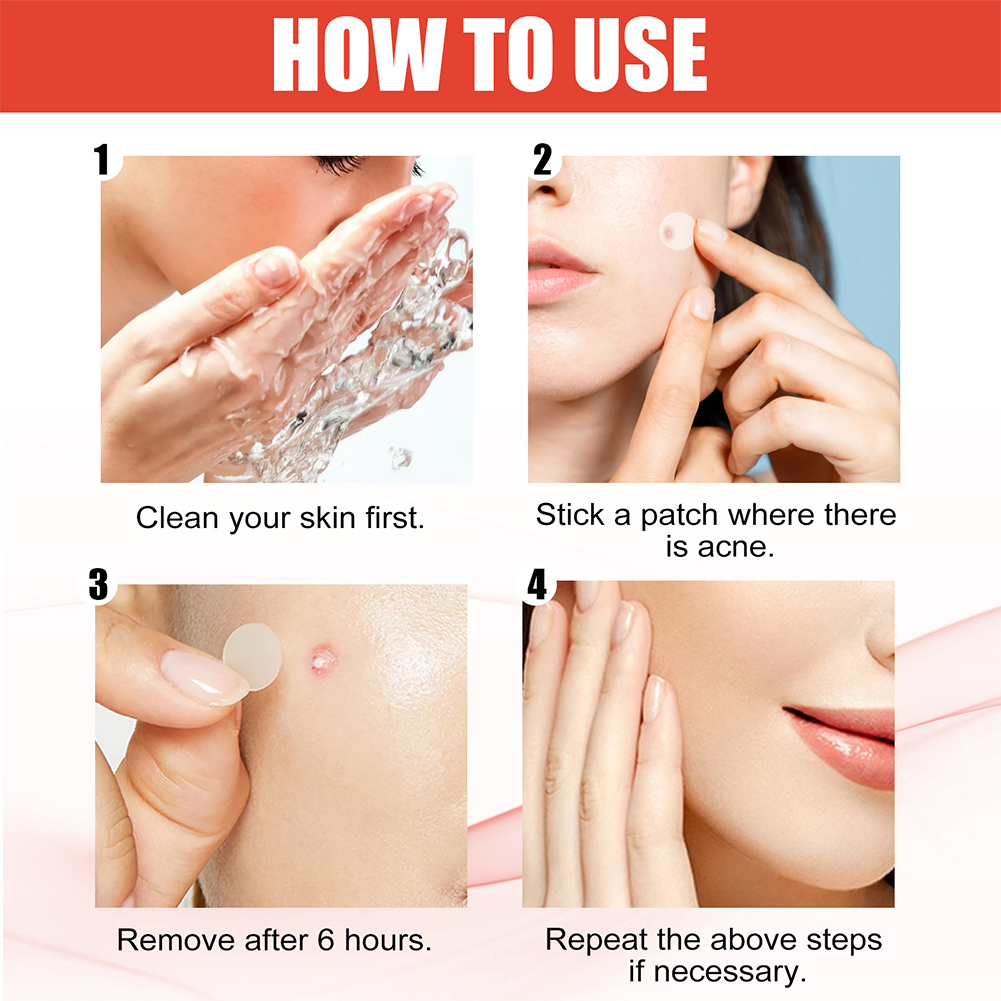 144 pz/set Viso Cura Della Pelle Acne Brufolo Patch 2 Formati Invisibile Guarigione Professionale Assorbente Spot Adesivo di Copertura per Le Donne Degli Uomini