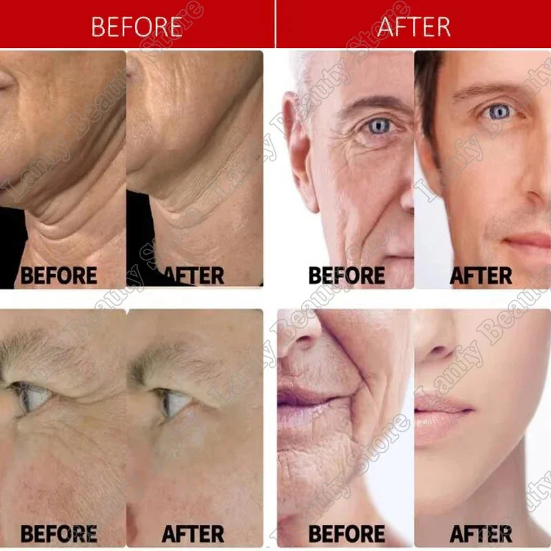 Instant Remove Wrinkle Cream Anti-Aging Fade Fine Lines Reduce Wrinkles Retinol Lifting Firming Whitening Moisturizing Face Skin