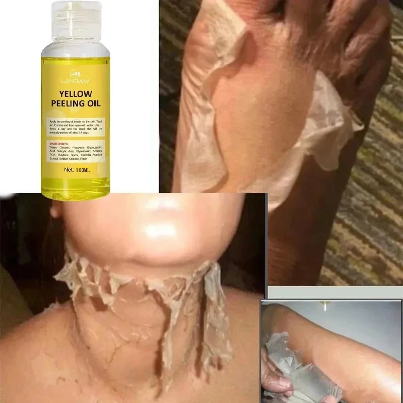 Witter Serum Geel Bleken Peeling Exfoliërende Dode Huidverzorgingsolie Donkere Huid Verwijderen Arm Kniebenen Melanine Body Fleuren Scrub