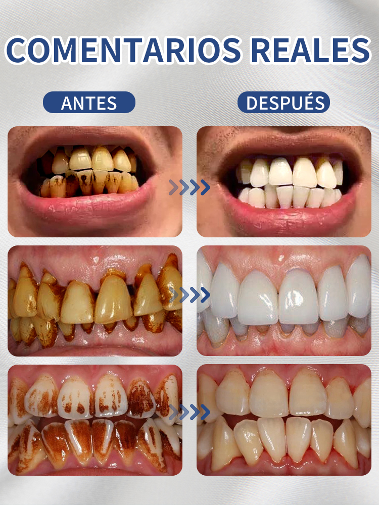 Un pincel y todo desaparecido