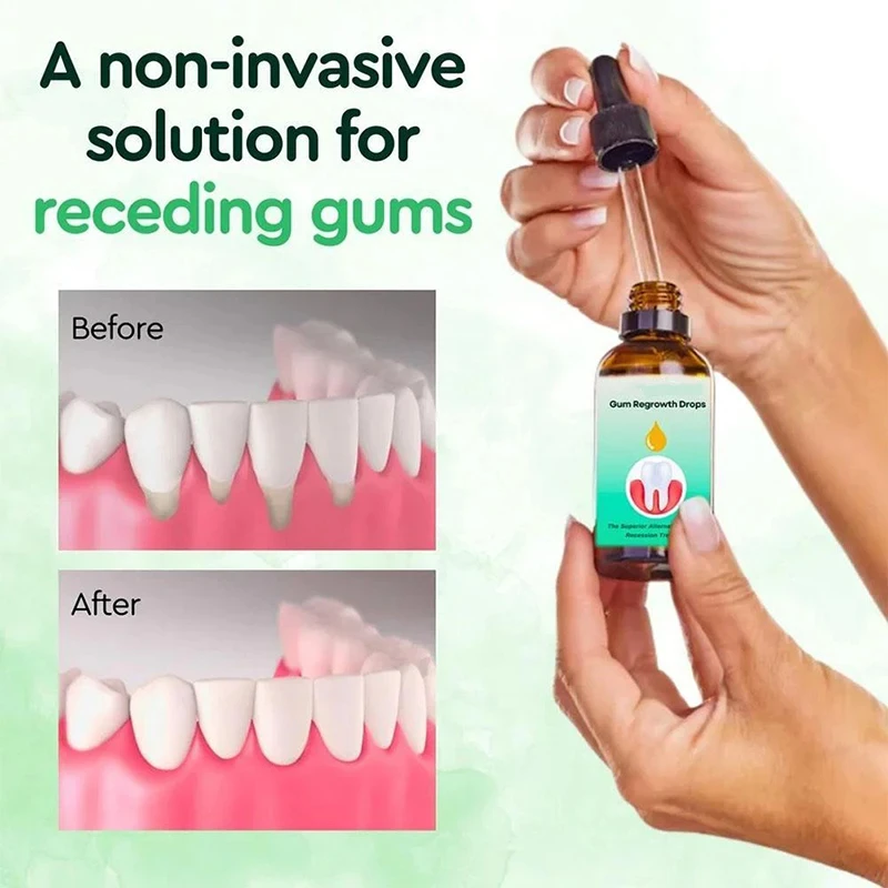 Gum Repair หยดบรรเทาถอนเหงือกบวมหมากฝรั่งทําความสะอาด Oral Periodontal สุขอนามัยลบคราบลบสีเหลือง Tartar