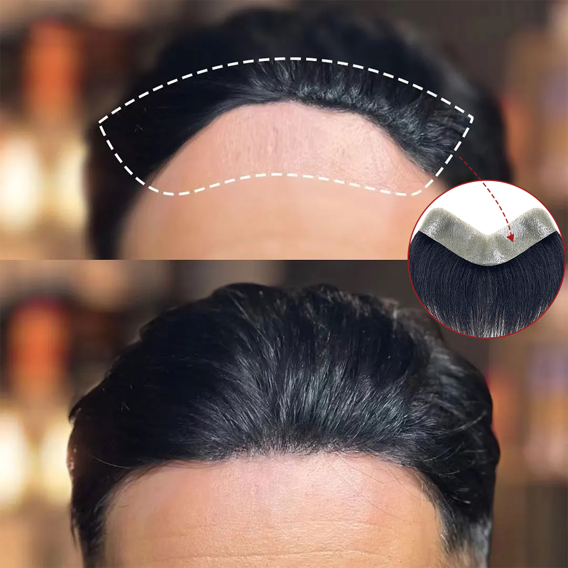 Peluquín frontal con bucle en V para hombre, 100% cabello humano frontal, sistema de reemplazo masculino de cabello Natural, postizo de PU, extensiones invisibles