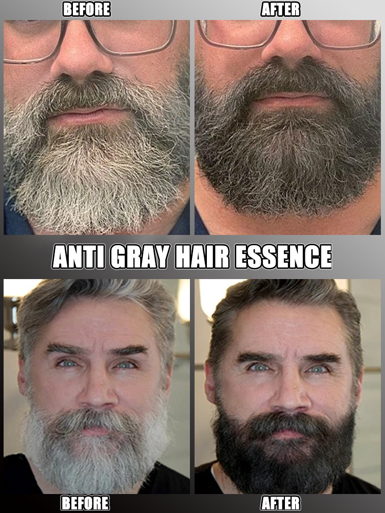 Eliminador de canas, resuelve perfectamente el problema de las canas y restaura el color natural del cabello.