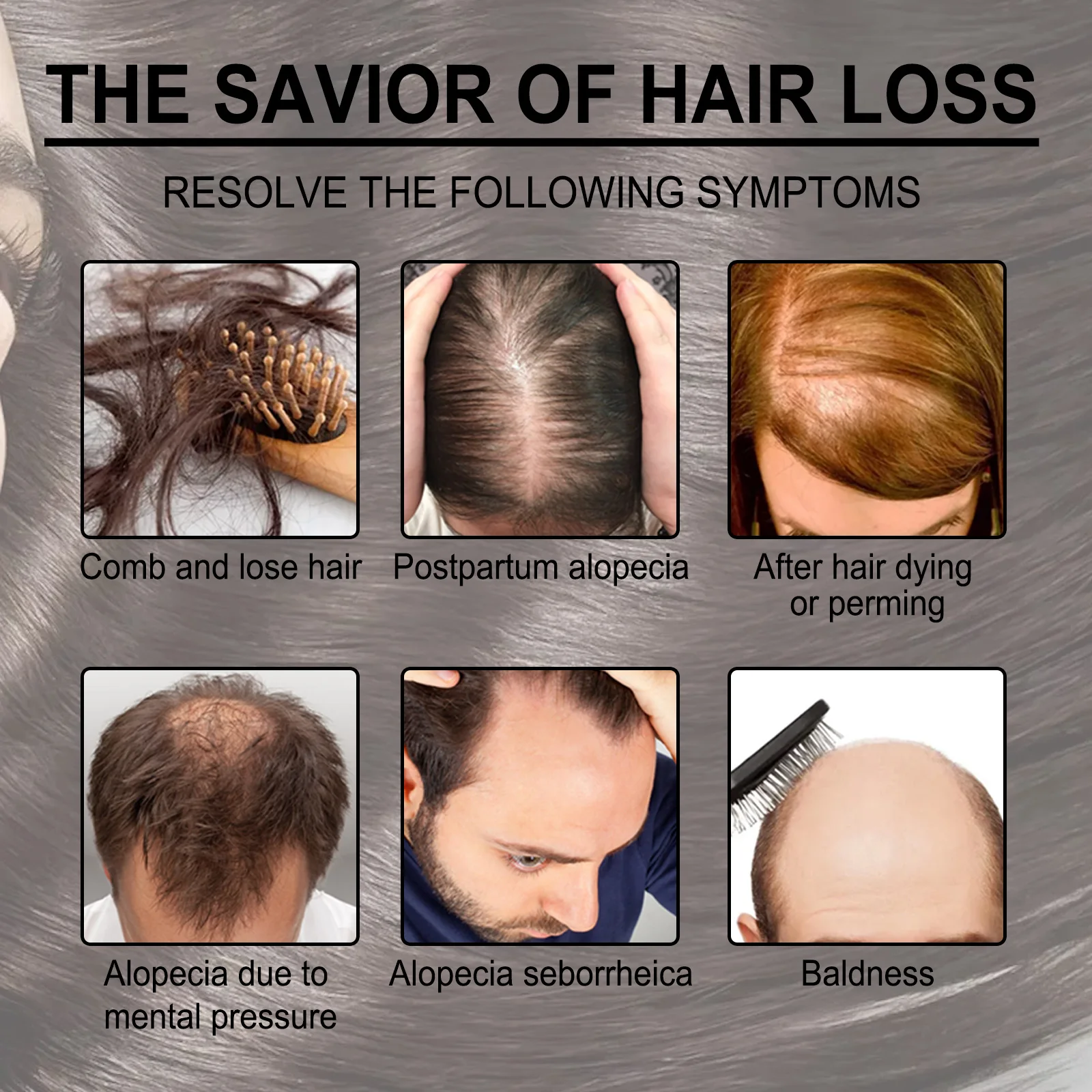 Óleo essencial de alecrim para cuidados com os cabelos, nutre o couro cabeludo, evita a perda de cabelo, fortalece as raízes do cabelo, produto orgânico natural para cuidados com os cabelos