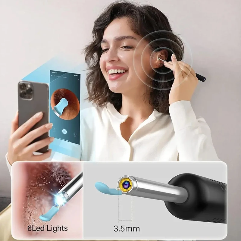 무선 WiFi 귀 선택 검 이경 카메라 내시경 빛나는 귀 왁스 청소 치아 구강 검사 건강 관리 귀 청소기 키트